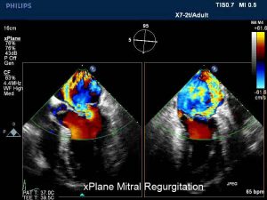 Read more about the article Centrul Medical Maycor, clinica de cardiologie din Galati