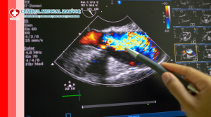 Ecografie Doppler Color și tehnici speciale ecocardiografice