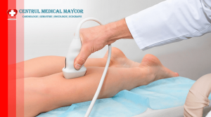 Ecografie de artere periferice