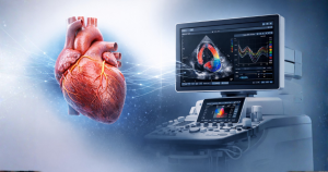 Read more about the article Cardiologia și tehnologia AI: cum transformă inteligența artificială interpretarea ecocardiografiilor moderne